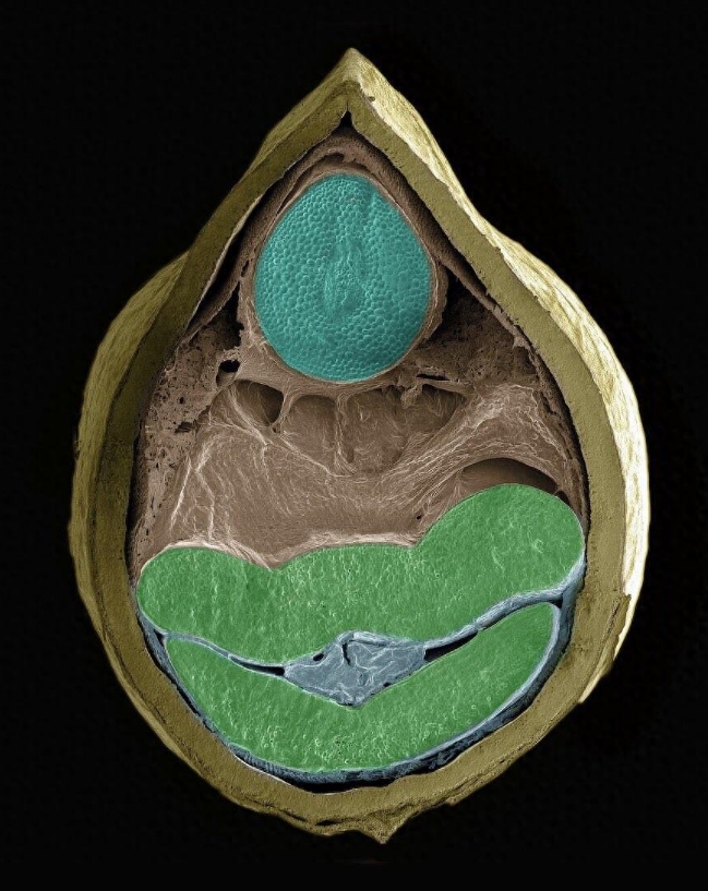 15幅令人驚嘆的顯微攝影作品，重新定義你對微觀世界的認(rèn)識