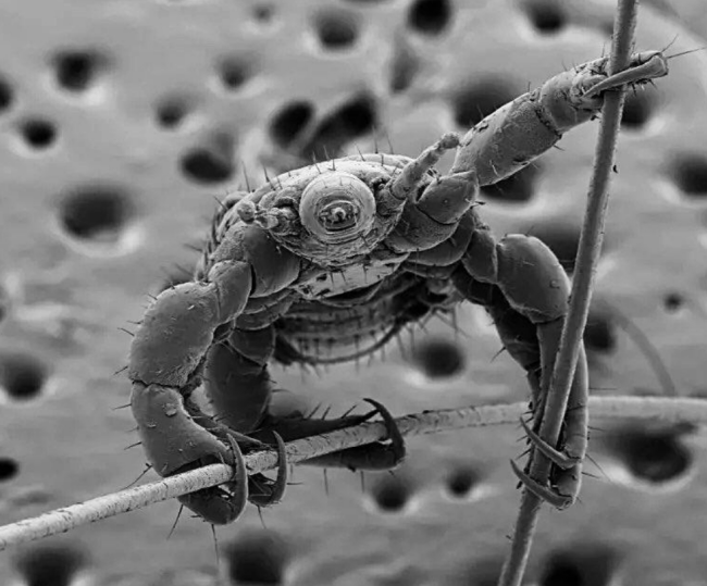 在電子顯微鏡的鏡頭下，頭虱正緊緊地附著在兩根人類頭發(fā)上